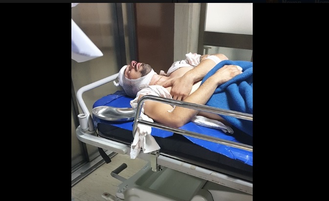 Slatina: Sedam muškaraca brutalno je pretuklo konobara, još se čeka reakcija policije