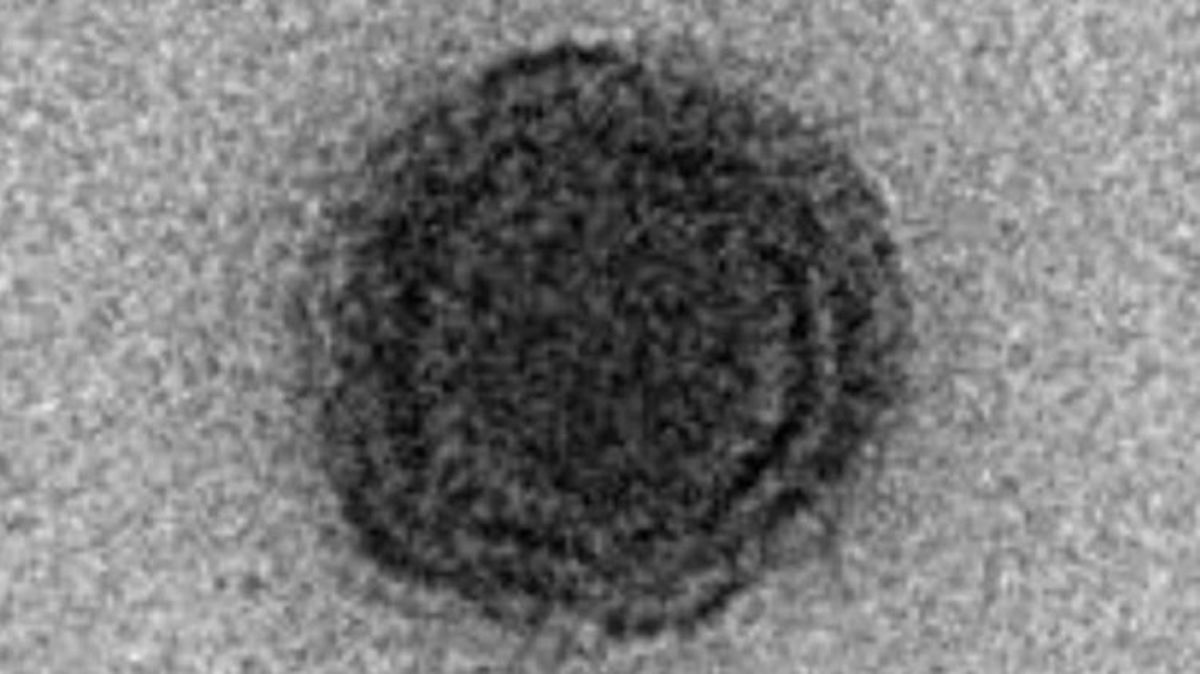 Brazilski znanstvenici otkrili posve nov i nepoznat divovski virus
