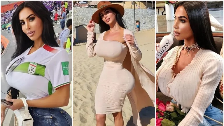 Do te je mjere izobličila guzu i grudi operacijama da snimka njezine šetnje plažom izaziva opće zgražanje