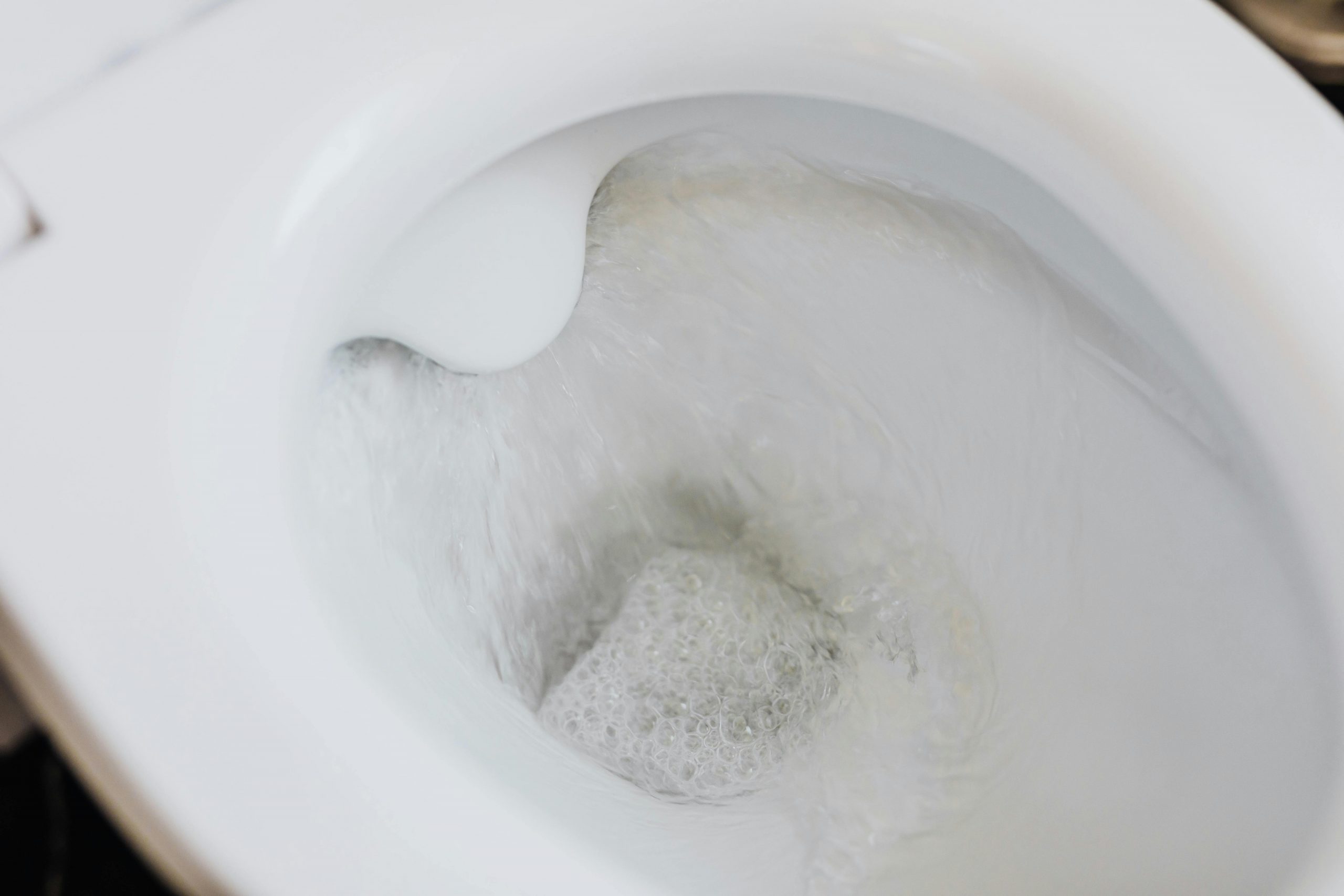 Može biti problematično za čišćenje: Uz pomoć jednog proizvoda riješite se kamenca iz WC školjke!
