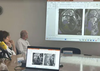 Nevjerojatan zahvat u KBC-u Zagreb: Liječnici carskim rezom napola izvadili bebu kako bi odstranili tumor koji joj je ugrožavao život