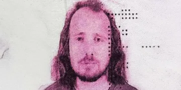 Novi smrtni slučaj nakon transplantacije kose: Britanac se samo srušio u hotelu u Istanbulu