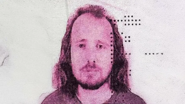 Novi smrtni slučaj nakon transplantacije kose: Britanac se samo srušio u hotelu u Istanbulu