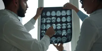 Moždani udar sve češće pogađa mlađe ljude: Znanstvenici otkrili zabrinjavajući trend, a kakva je situacija u Hrvatskoj?